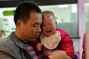 Needles removed from baby's body