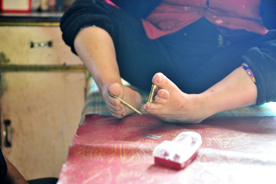 Disabled woman uses her feet to care for husband