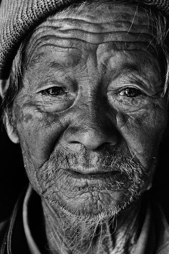 The forgotten faces of war