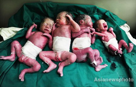 Mother gives birth to quadruplets in Central China