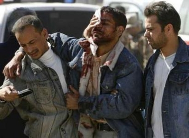 A man wounded in a car bomb attack walks to al-Kindi hospital in Baghdad February 12, 2007. A car bomb attack at a market in central Baghdad on Monday killed 31 people and wounded 77, police said. REUTERS