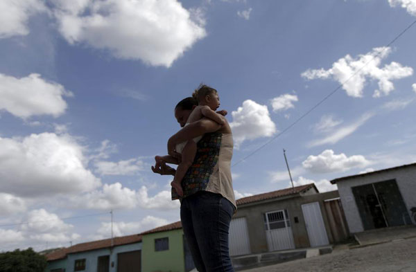 US health authorities confirm Zika causes microcephaly